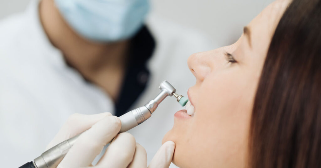 Dentista realizando limpeza dentária, a profilaxia, ou limpeza dental: procedimento preventivo mais básico e fundamental para manutenção da saúde bucal.