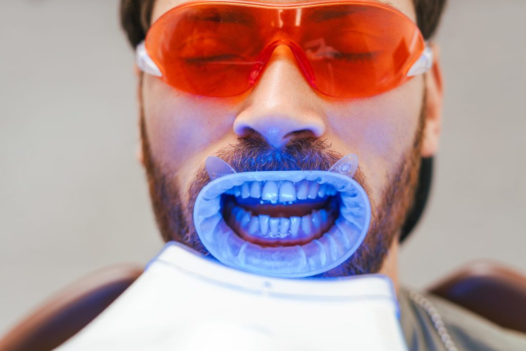 Uma pessoa com afastador labial, recebendo aplicação de laser ou luz de led para clareamento dental.