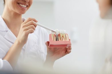 Implante Dentário em um dia